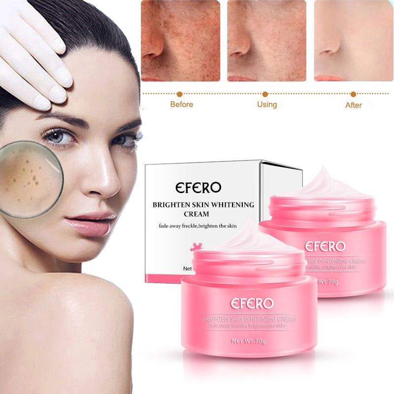 Skin Whitening Cream Freckle Cream Remove Acne Dark Pigment Spots Melanin Pimple Cream Face Cream Face Serum Skin Care - Gufetto Brand 