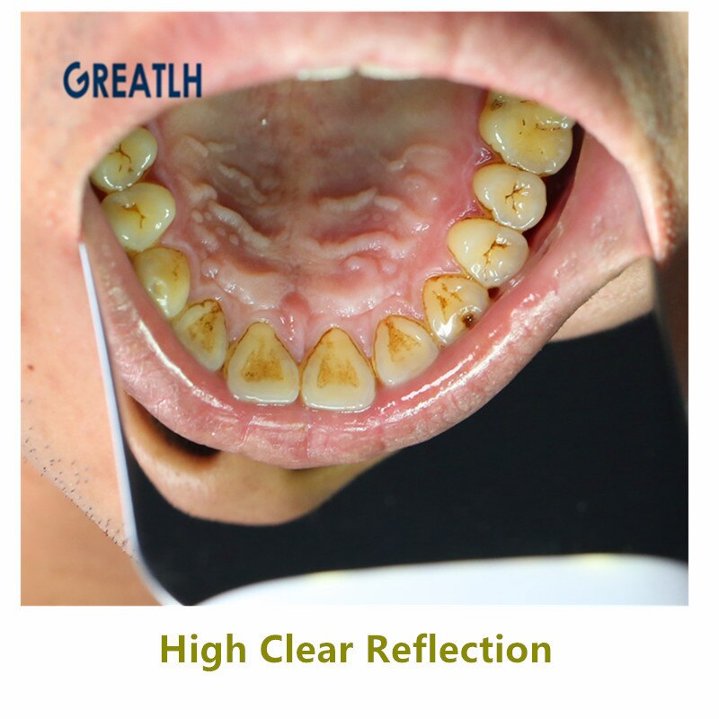 Specchi per fotografia orale dentale - Gufetto Brand 